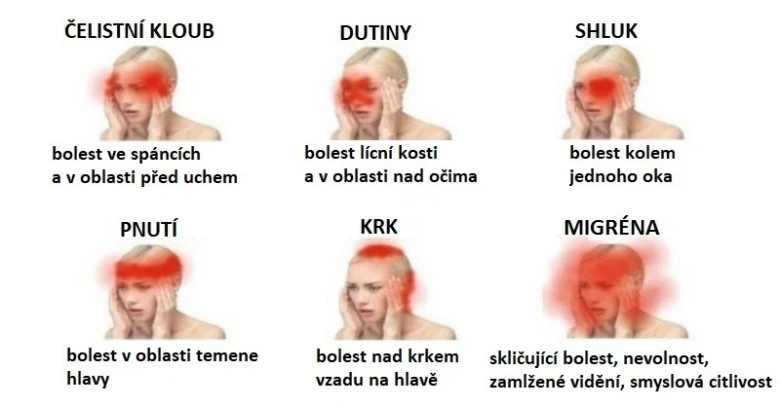 Mapa bolesti hlavy: čelistní kloub, dutiny, shluk, pnutí, krk, migréna