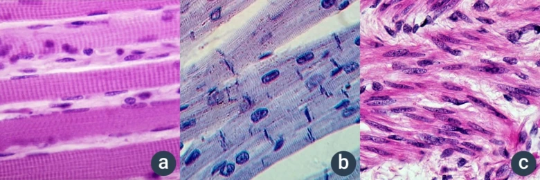 Histologické snímky svalových tkání: kosterní, srdeční a hladké